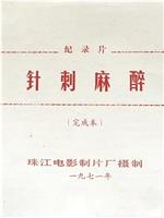 针刺麻醉